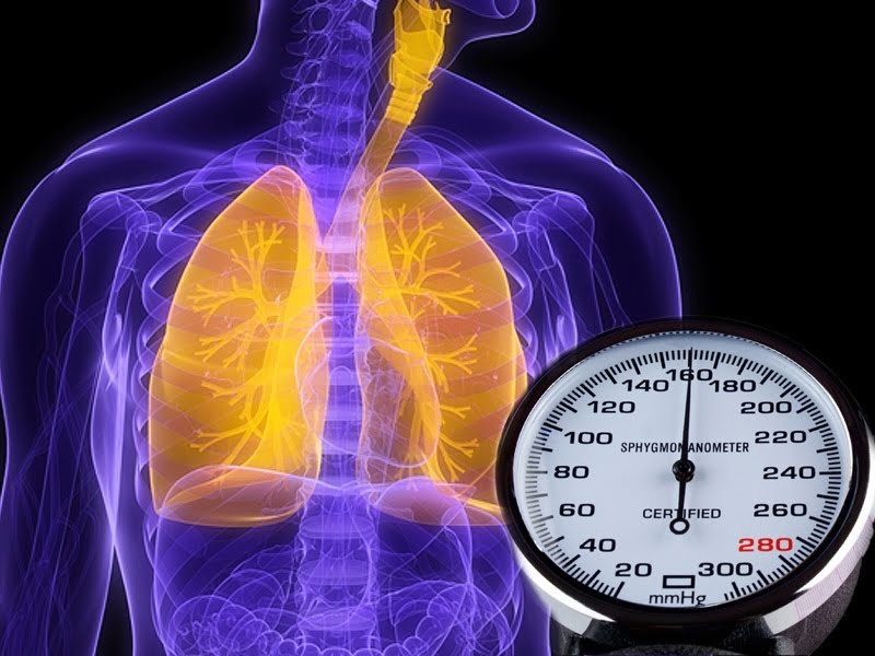 Akciğer hipertansiyonu nedir?