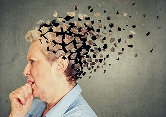 Alzheimer için korkutan uyarı; 2050’de Türkiye 4’üncü sırada