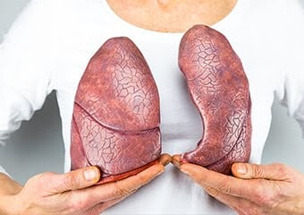 Kapalı yöntem akciğer kanseri ameliyatları: Vats lobektomi