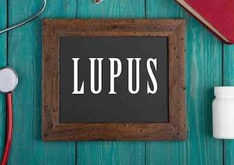 Lupus hastalığına dair her şey