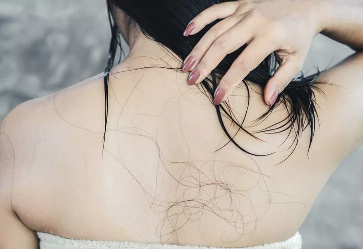 Hair loss affects women negatively. So how should precautions be taken?